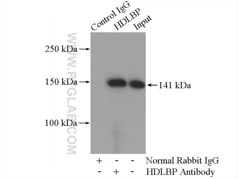 Immunoprecipitation (IP) experiment of Jurkat cells using HDLBP Polyclonal antibody (15406-1-AP)