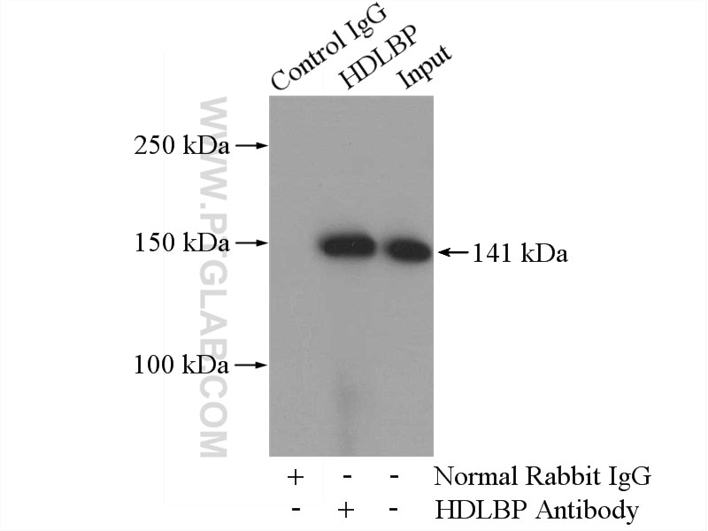 IP experiment of Jurkat using 15406-1-AP