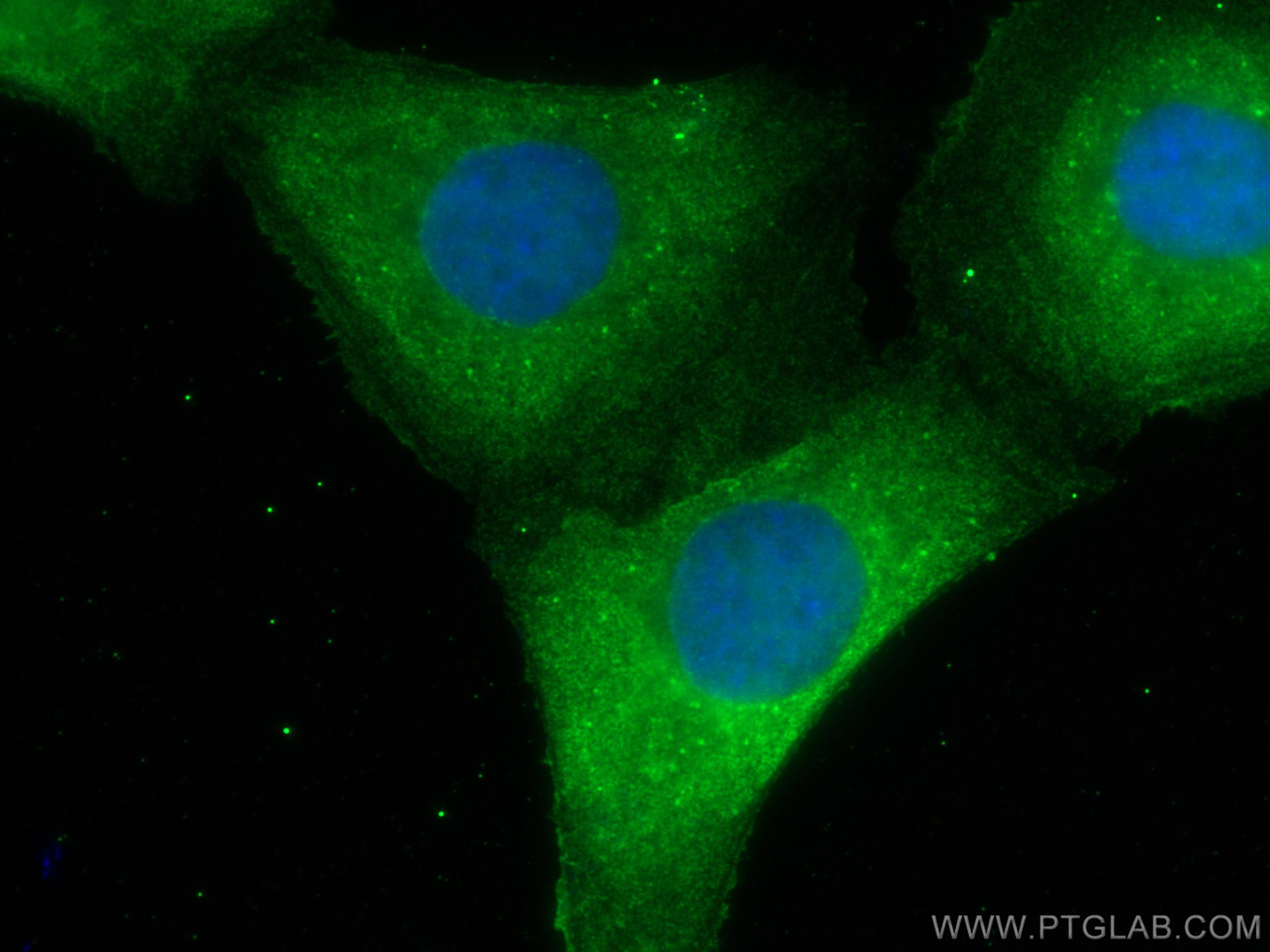 Immunofluorescence (IF) / fluorescent staining of SKOV-3 cells using HE4 Monoclonal antibody (66557-1-Ig)