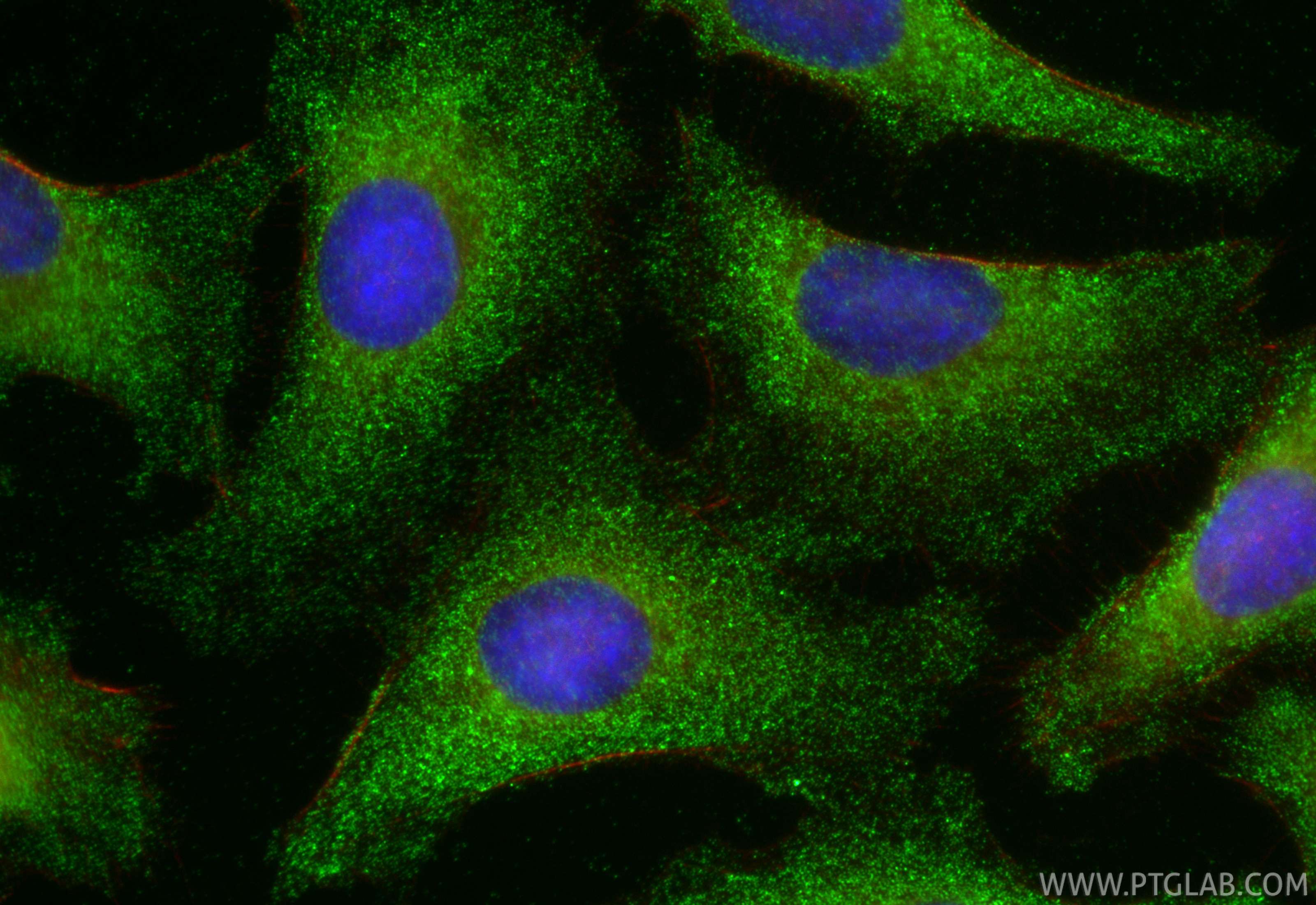 Immunofluorescence (IF) / fluorescent staining of SKOV-3 cells using HE4 Monoclonal antibody (66557-1-Ig)