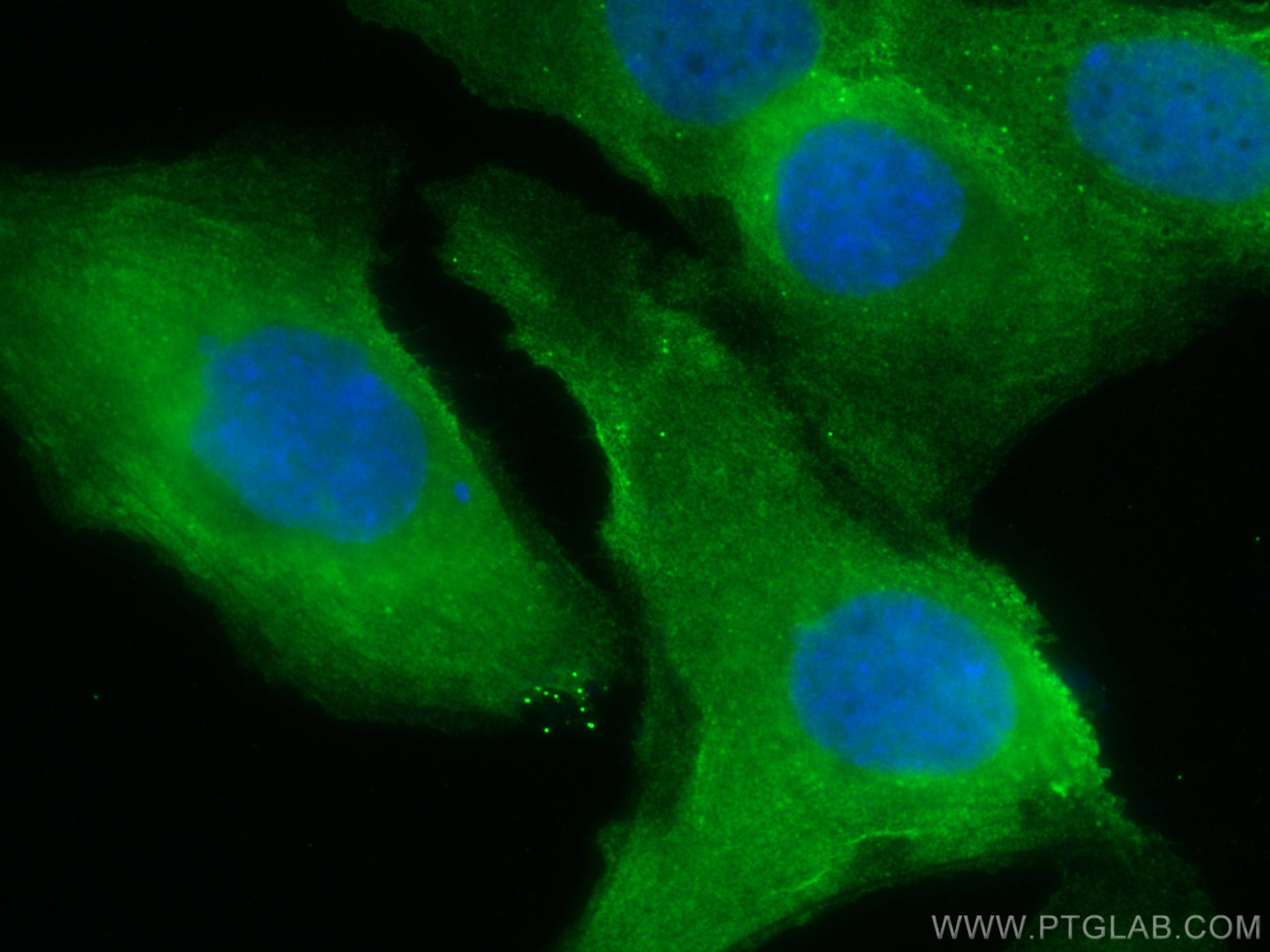Immunofluorescence (IF) / fluorescent staining of SKOV-3 cells using CoraLite® Plus 488-conjugated HE4 Monoclonal antib (CL488-66557)