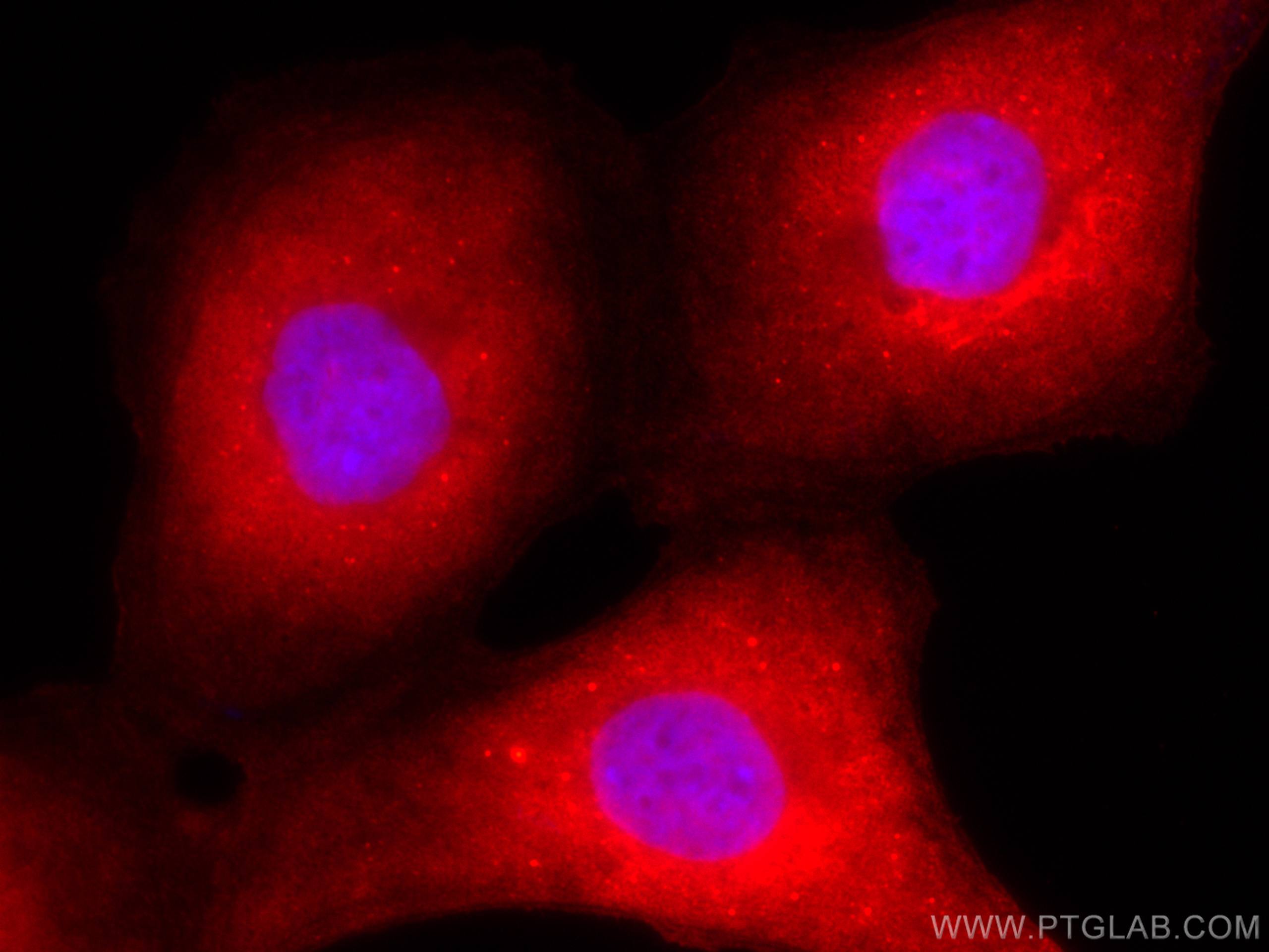 Immunofluorescence (IF) / fluorescent staining of SKOV-3 cells using CoraLite®594-conjugated HE4 Monoclonal antibody (CL594-66557)