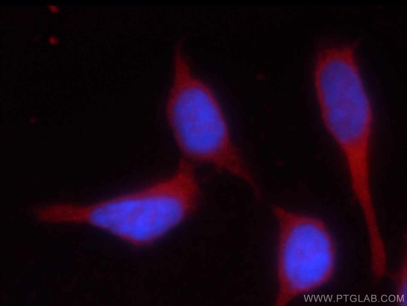 Immunofluorescence (IF) / fluorescent staining of HEK-293 cells using HEATR2 Polyclonal antibody (24578-1-AP)