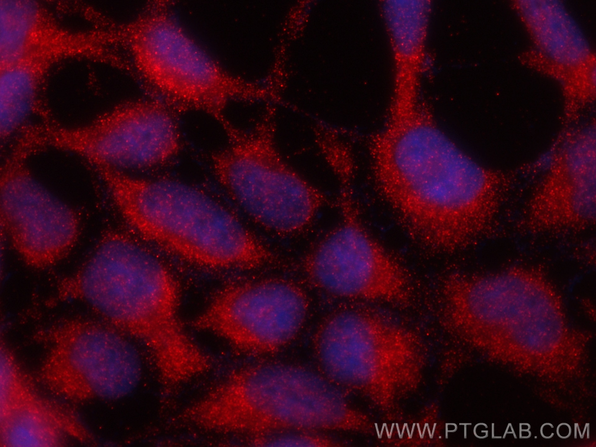 Immunofluorescence (IF) / fluorescent staining of HEK-293 cells using HEATR2 Polyclonal antibody (24578-1-AP)