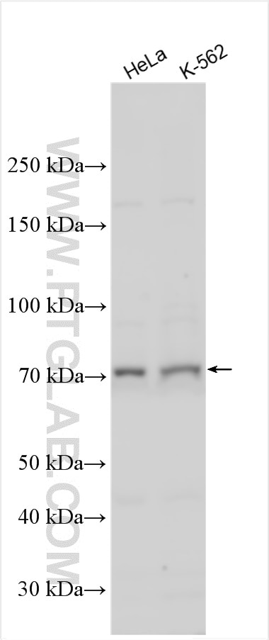 Western Blot (WB) analysis of various lysates using HEATR3 Polyclonal antibody (27335-1-AP)