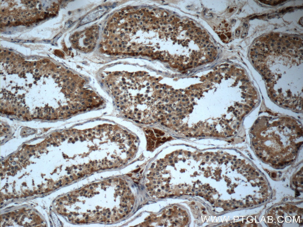 Immunohistochemistry (IHC) staining of human testis tissue using HEATR4 Polyclonal antibody (23944-1-AP)