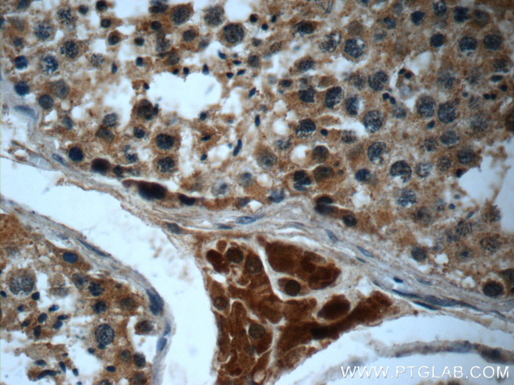 Immunohistochemistry (IHC) staining of human testis tissue using HEATR4 Polyclonal antibody (23944-1-AP)
