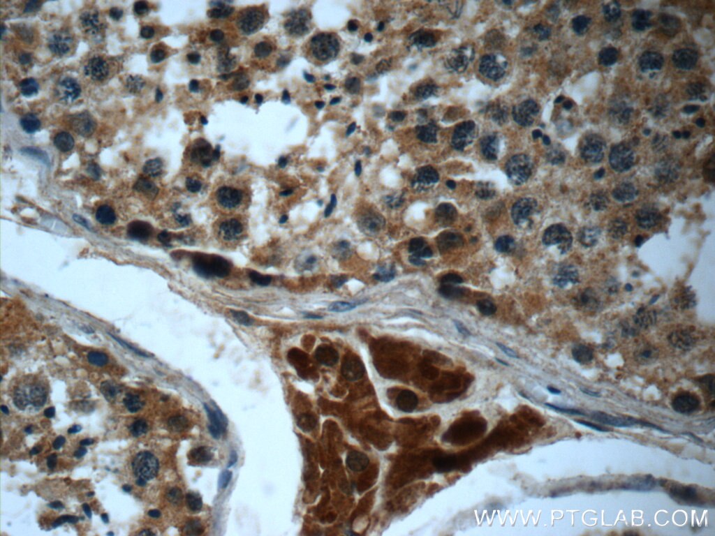 IHC staining of human testis using 23944-1-AP