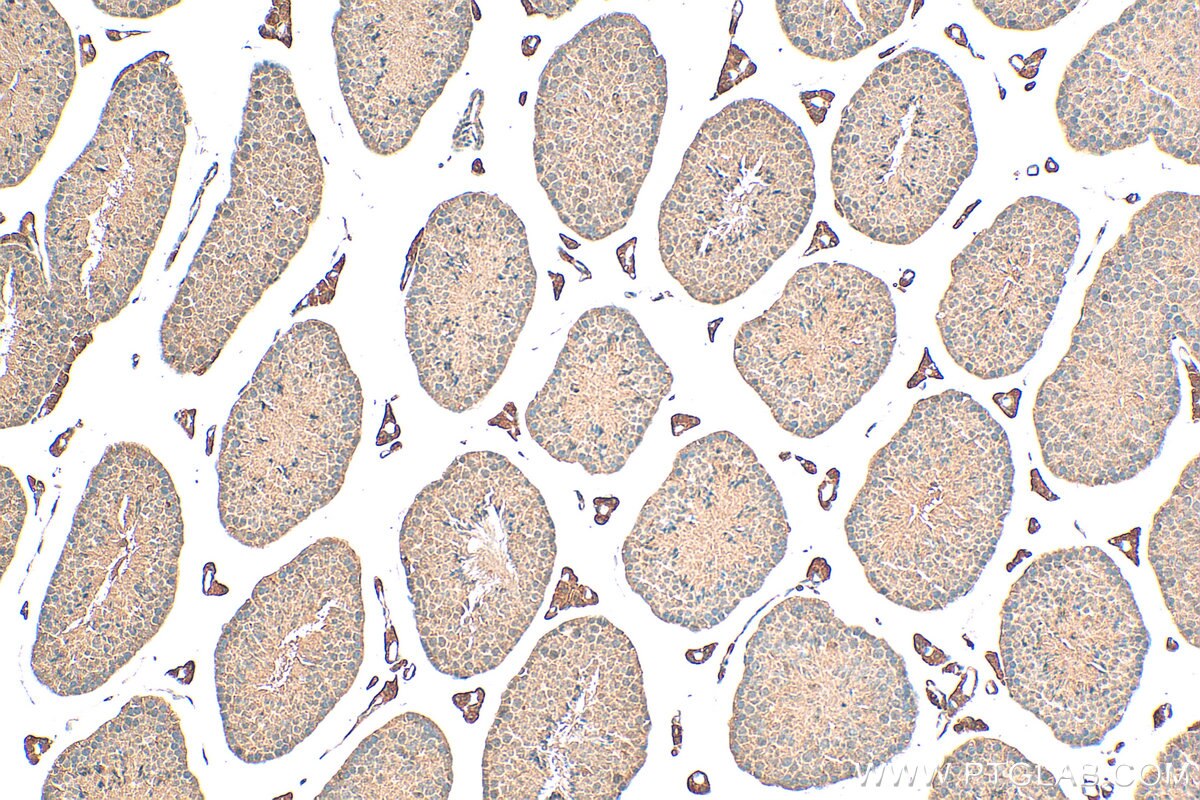 Immunohistochemistry (IHC) staining of mouse testis tissue using HEATR4 Polyclonal antibody (23944-1-AP)