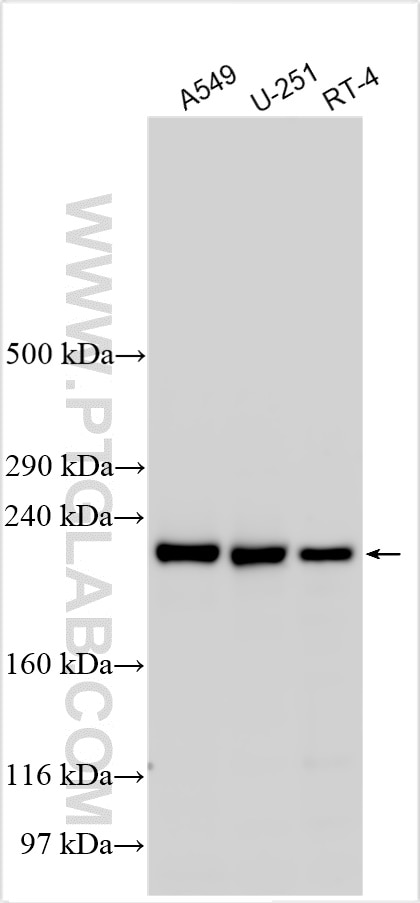 Western Blot (WB) analysis of various lysates using HEATR5B Polyclonal antibody (32316-1-AP)