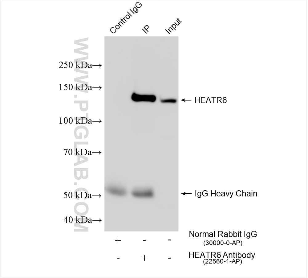 Immunoprecipitation (IP) experiment of MCF-7 cells using HEATR6 Polyclonal antibody (22560-1-AP)