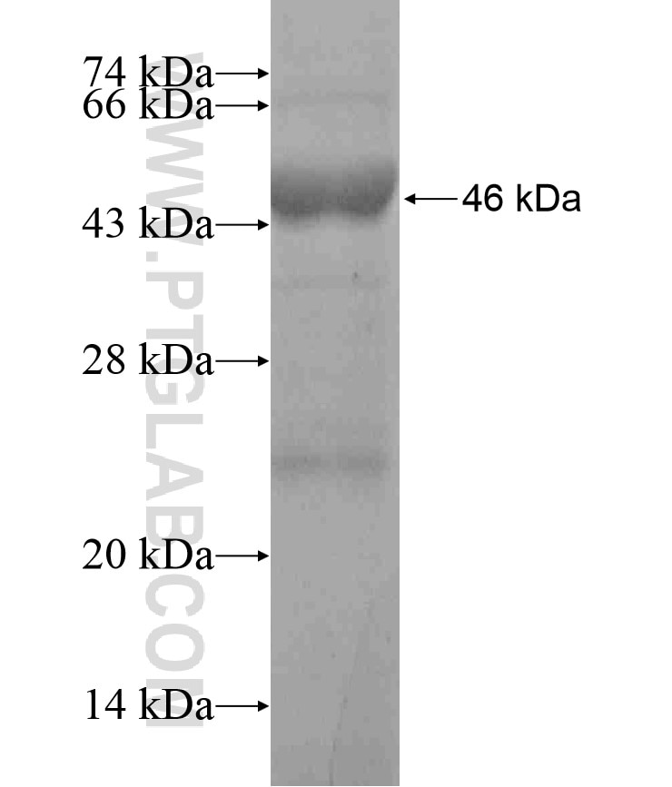HEATR6 fusion protein Ag18441 SDS-PAGE