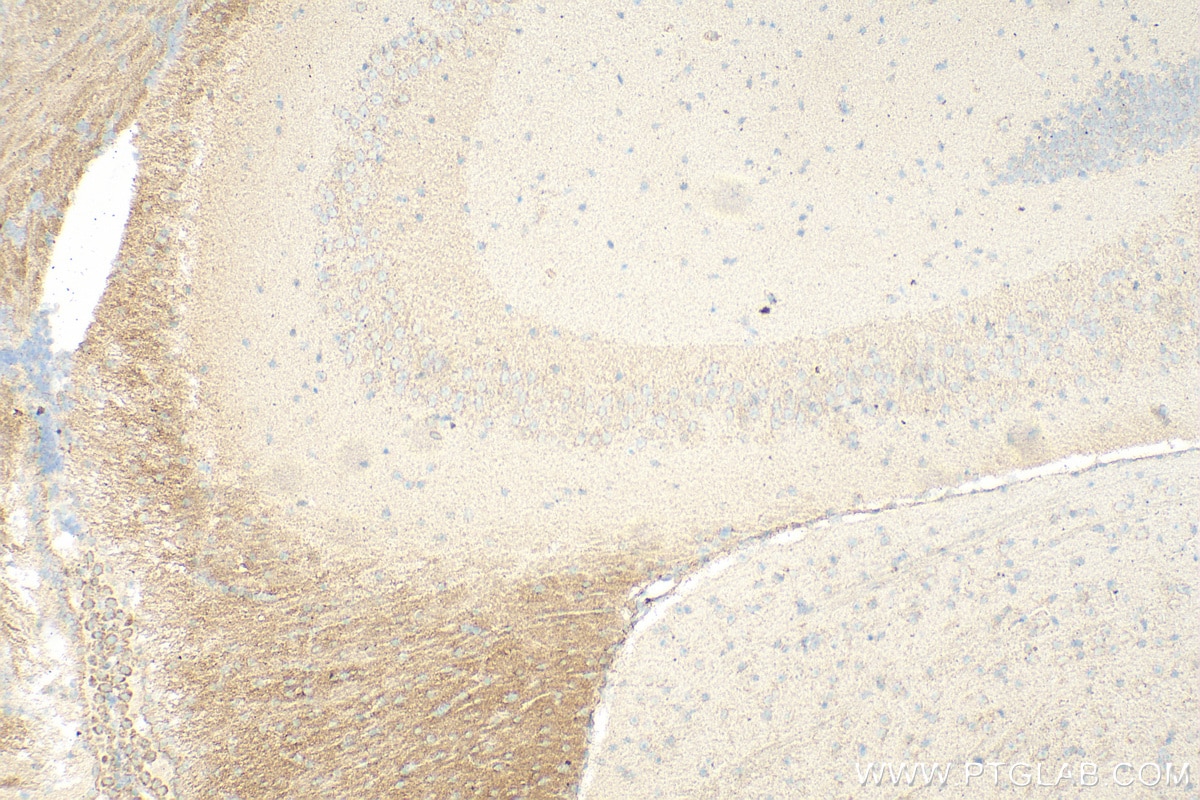 Immunohistochemistry (IHC) staining of mouse brain tissue using HEBP1 Polyclonal antibody (16842-1-AP)