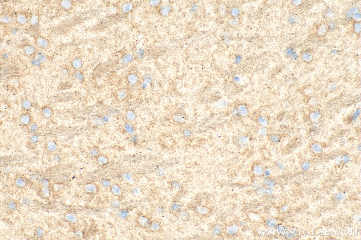Immunohistochemistry (IHC) staining of mouse brain tissue using HEBP1 Polyclonal antibody (16842-1-AP)