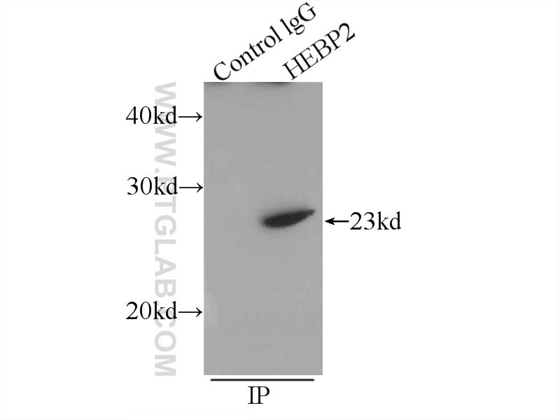 Immunoprecipitation (IP) experiment of HEK-293 cells using HEBP2 Polyclonal antibody (12706-1-AP)