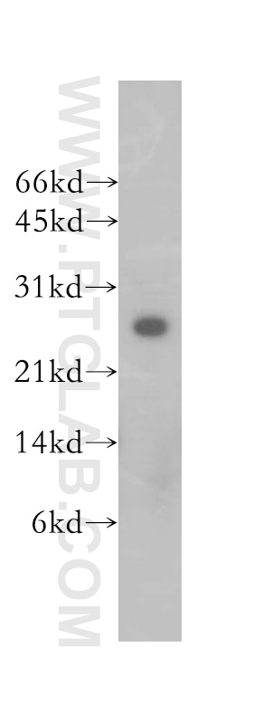 Western Blot (WB) analysis of human brain tissue using HEBP2 Polyclonal antibody (12706-1-AP)