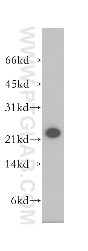 Western Blot (WB) analysis of human kidney tissue using HEBP2 Polyclonal antibody (12706-1-AP)
