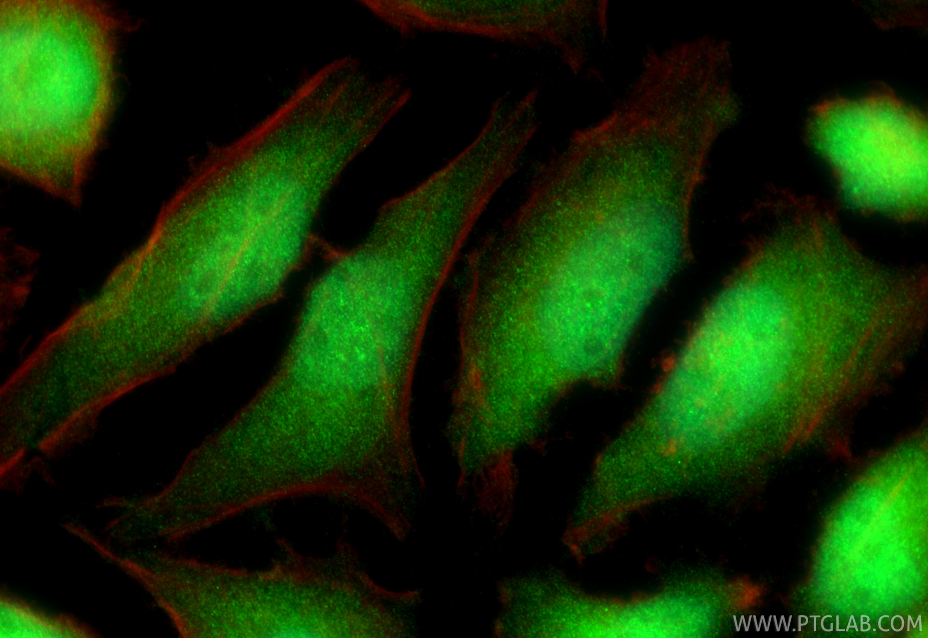 Immunofluorescence (IF) / fluorescent staining of HeLa cells using HECTD1 Polyclonal antibody (20605-1-AP)