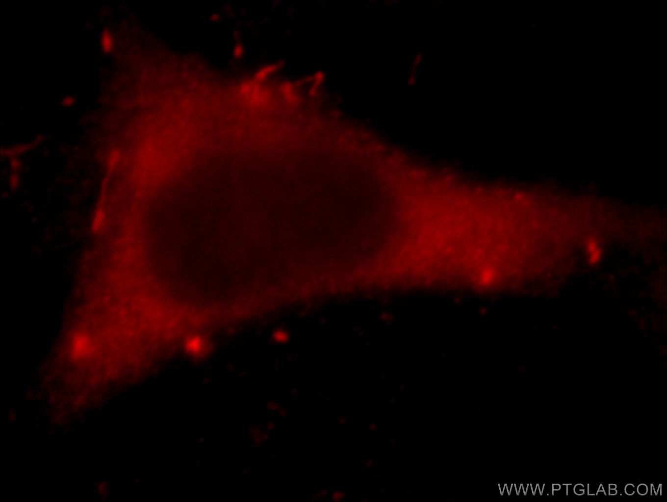 Immunofluorescence (IF) / fluorescent staining of HeLa cells using HECTD1 Polyclonal antibody (20605-1-AP)