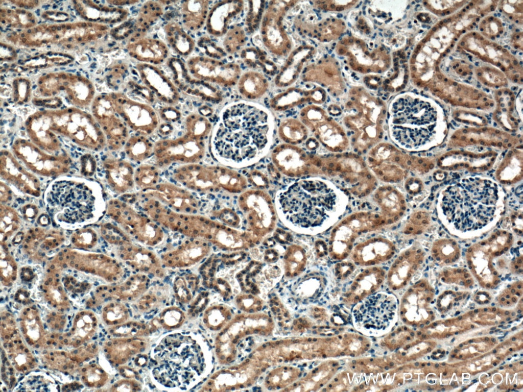 Immunohistochemistry (IHC) staining of human kidney tissue using HECTD1 Polyclonal antibody (20605-1-AP)