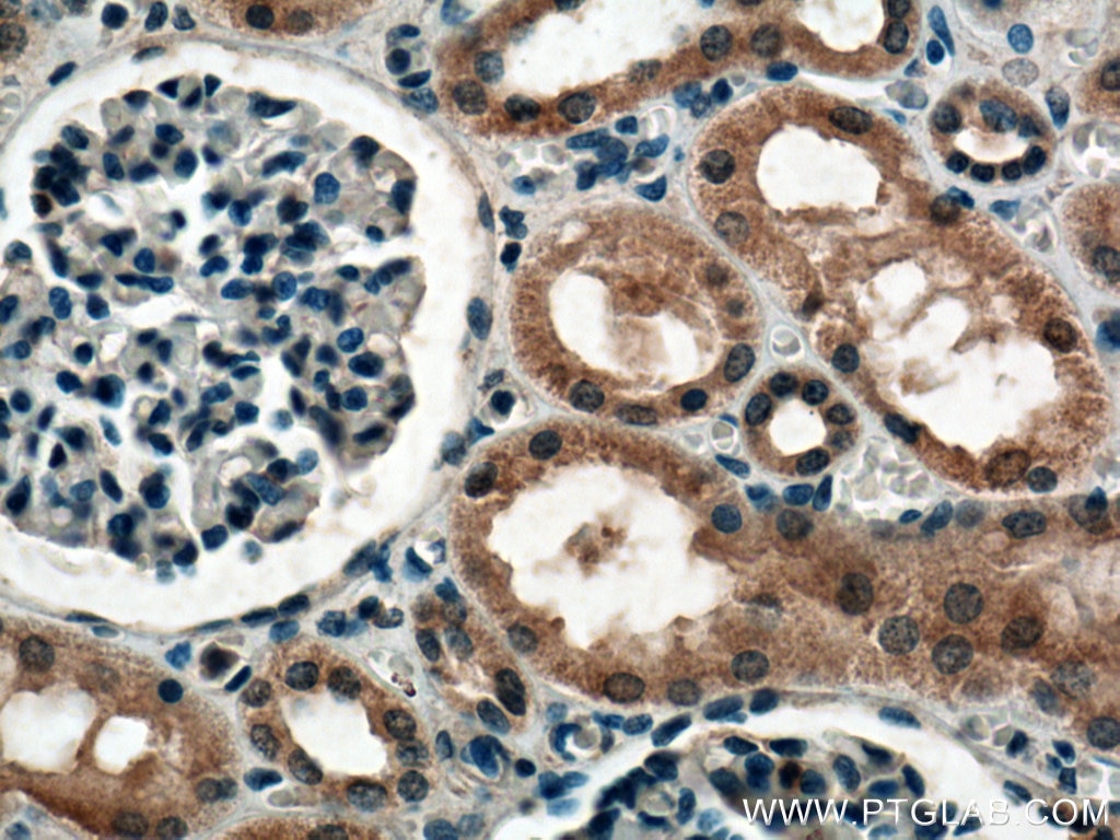 Immunohistochemistry (IHC) staining of human kidney tissue using HECTD1 Polyclonal antibody (20605-1-AP)