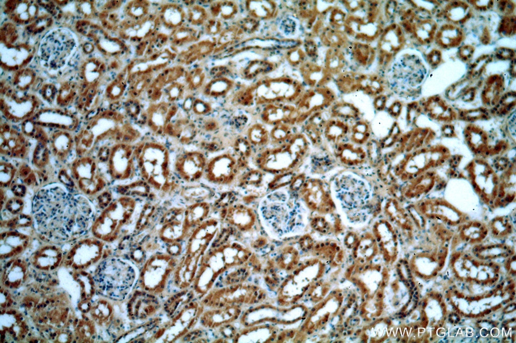 Immunohistochemistry (IHC) staining of human kidney tissue using HECTD1 Polyclonal antibody (20605-1-AP)