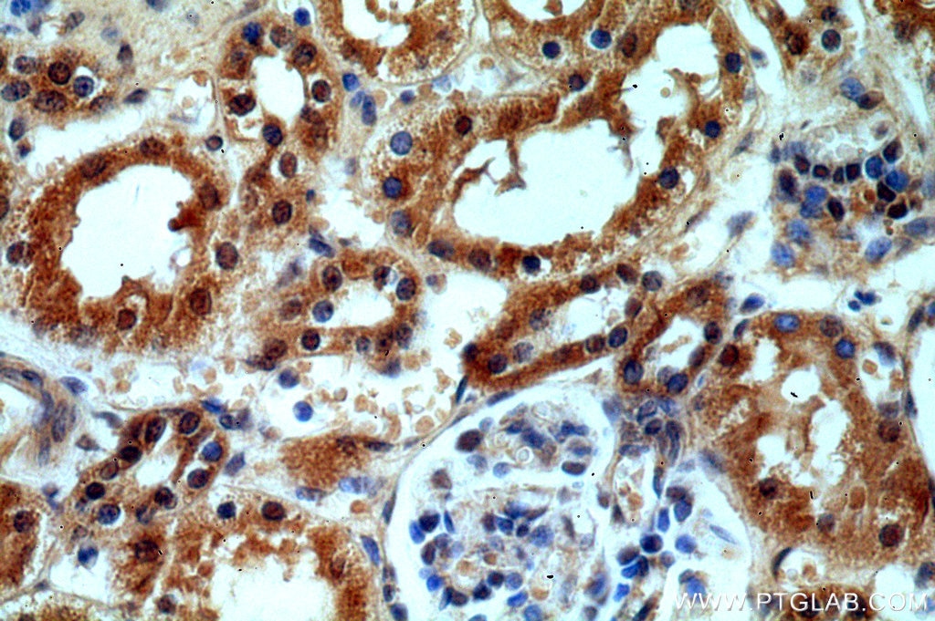 Immunohistochemistry (IHC) staining of human kidney tissue using HECTD1 Polyclonal antibody (20605-1-AP)