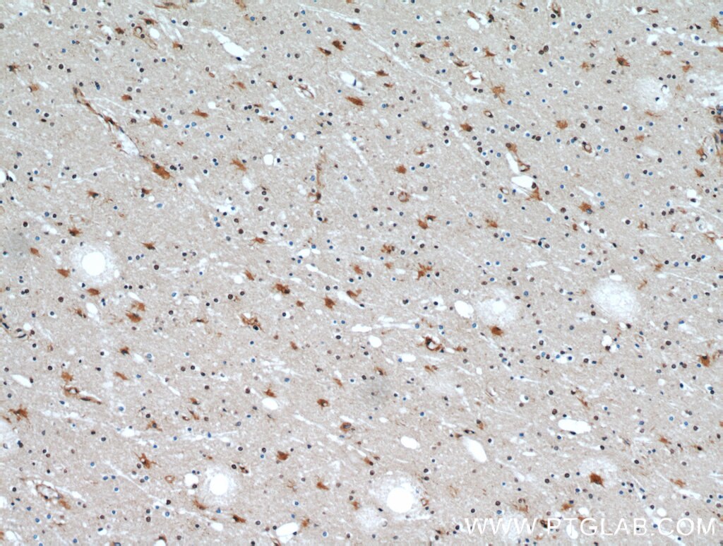 IHC staining of human brain using 20605-1-AP