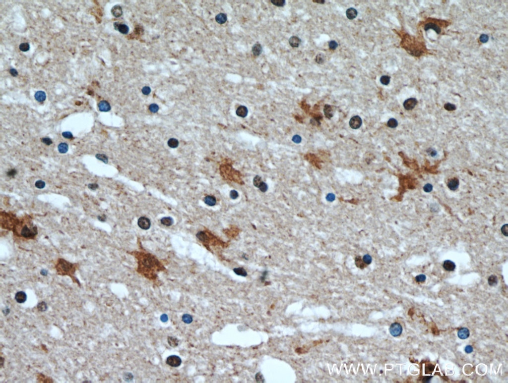 Immunohistochemistry (IHC) staining of human brain tissue using HECTD1 Polyclonal antibody (20605-1-AP)