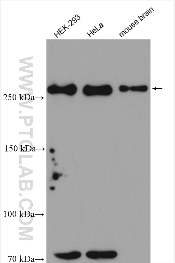 Western Blot (WB) analysis of various lysates using HECTD1 Polyclonal antibody (20605-1-AP)