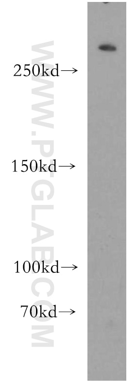 Western Blot (WB) analysis of human brain tissue using HECTD1 Polyclonal antibody (20605-1-AP)