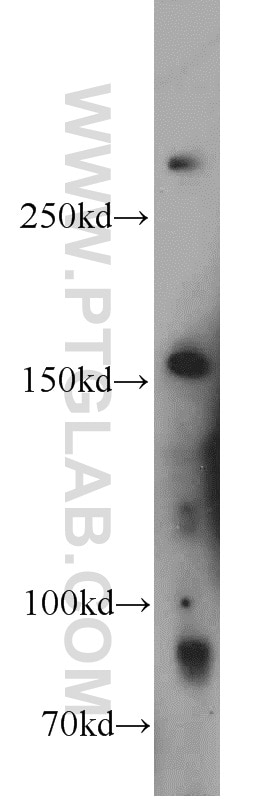 Western Blot (WB) analysis of human brain tissue using HECTD1 Polyclonal antibody (20605-1-AP)