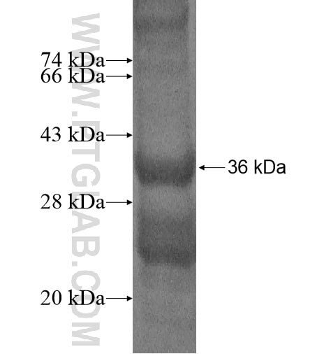HECTD1 fusion protein Ag14581 SDS-PAGE