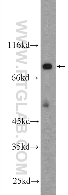 Western Blot (WB) analysis of mouse brain tissue using HECTD2 Polyclonal antibody (25351-1-AP)