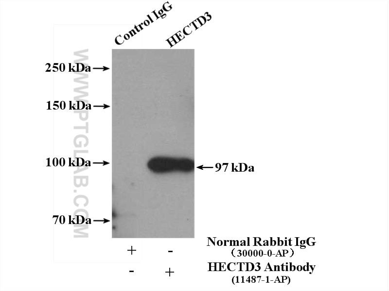 Immunoprecipitation (IP) experiment of MDA-MB-453s cells using HECTD3 Polyclonal antibody (11487-1-AP)