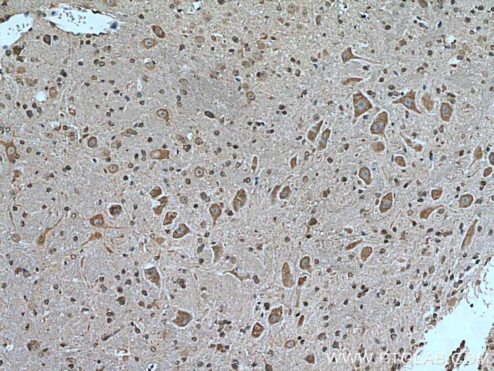 Immunohistochemistry (IHC) staining of mouse cerebellum tissue using HECW1 Polyclonal antibody (24695-1-AP)