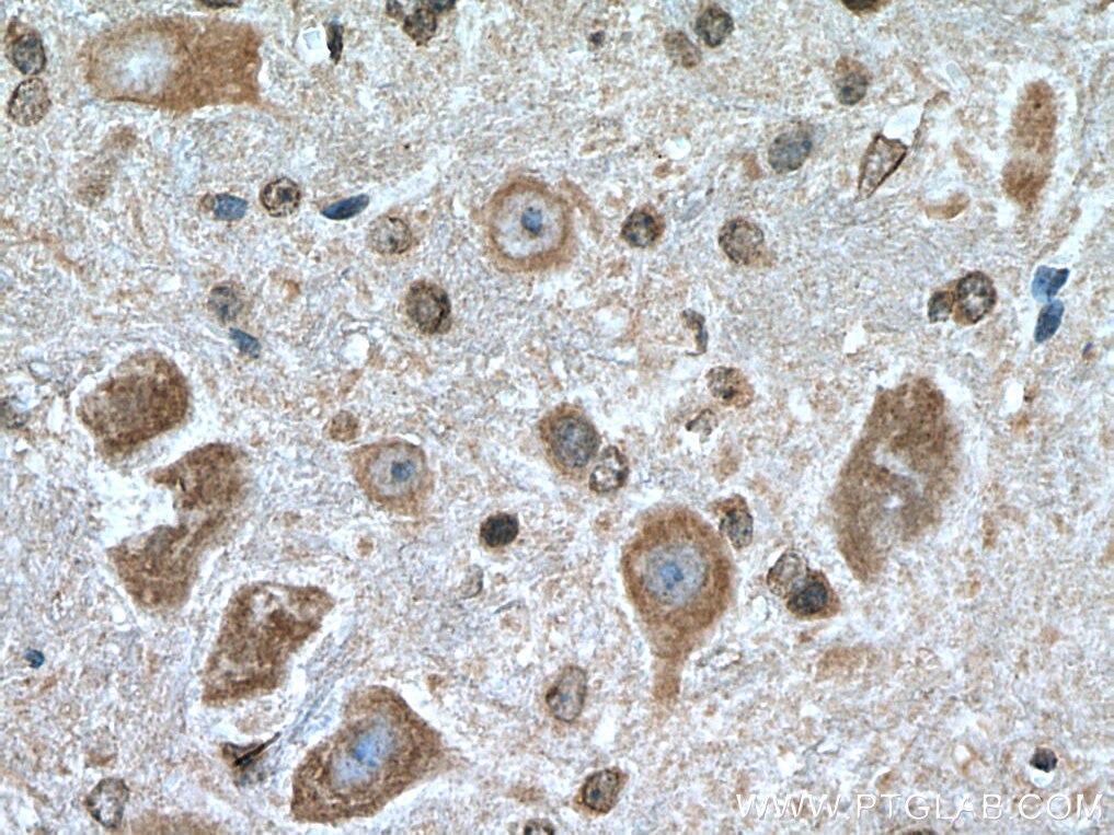 Immunohistochemistry (IHC) staining of mouse cerebellum tissue using HECW1 Polyclonal antibody (24695-1-AP)