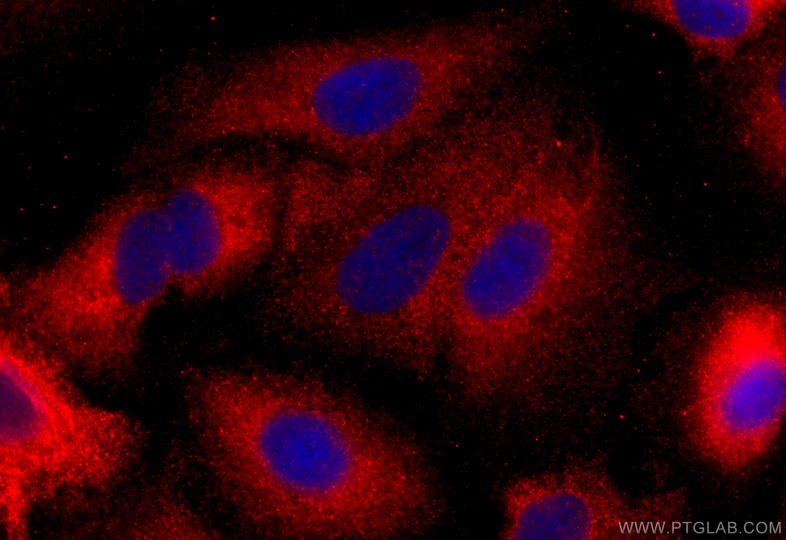 Immunofluorescence (IF) / fluorescent staining of A549 cells using HECW2 Polyclonal antibody (32026-1-AP)