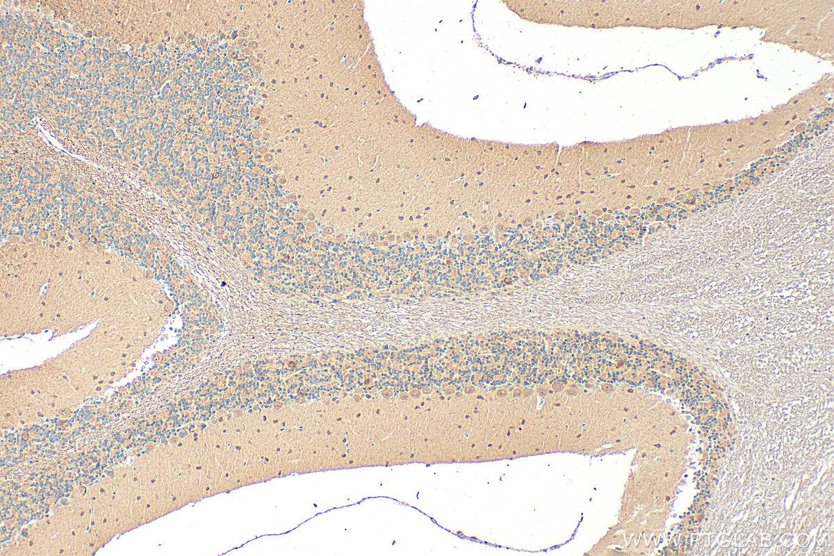 Immunohistochemistry (IHC) staining of mouse cerebellum tissue using HECW2 Polyclonal antibody (32026-1-AP)