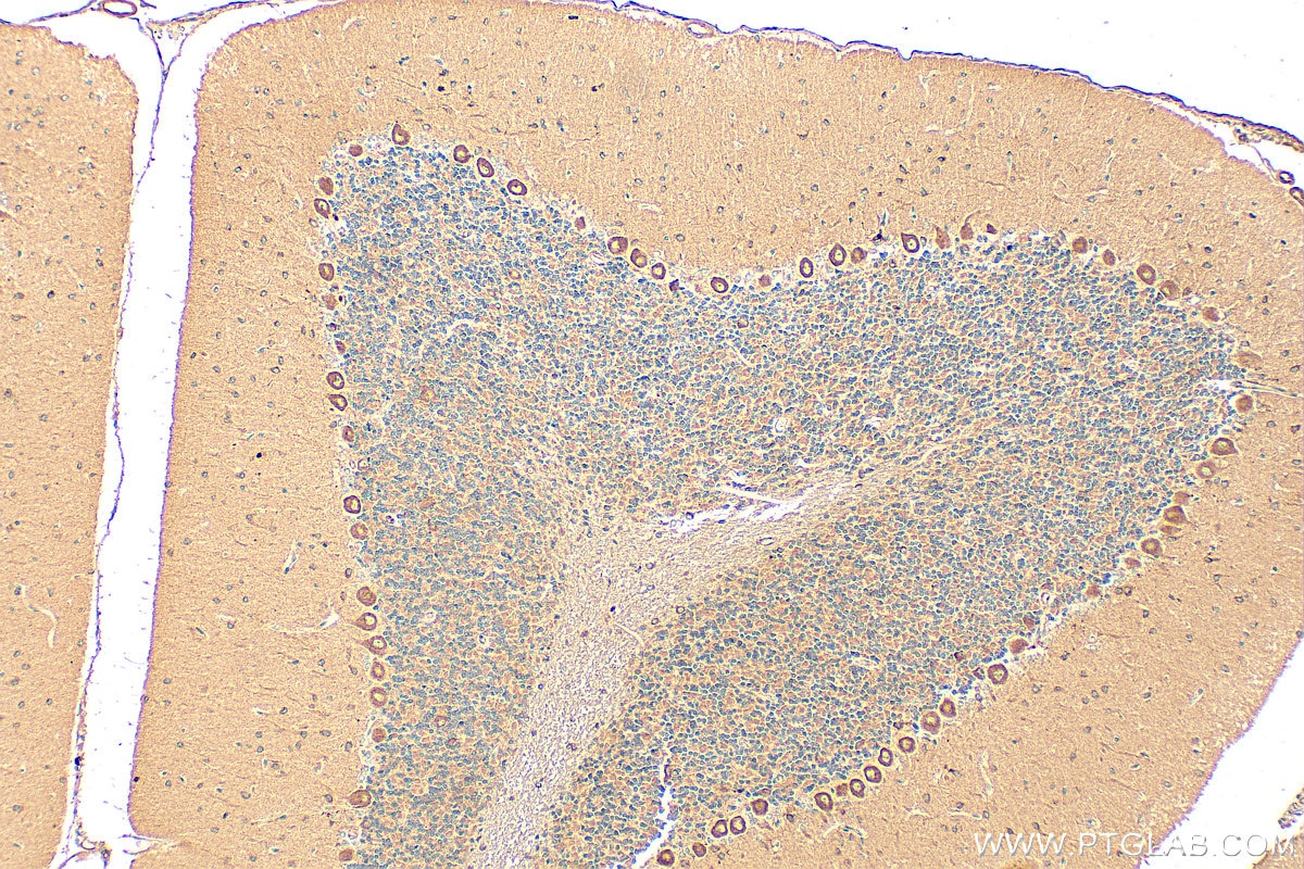 Immunohistochemistry (IHC) staining of rat cerebellum tissue using HECW2 Polyclonal antibody (32026-1-AP)
