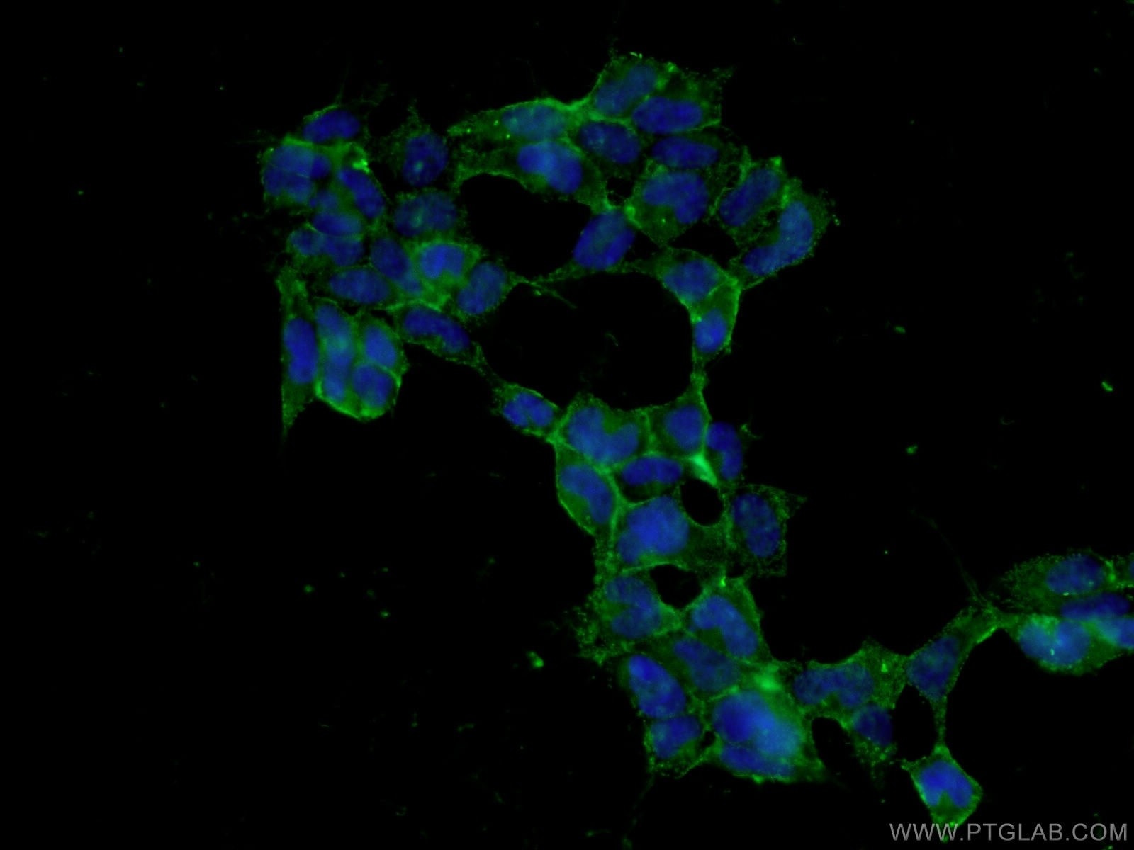 Immunofluorescence (IF) / fluorescent staining of HEK-293 cells using HEK 293 cells Polyclonal antibody (27347-1-AP)
