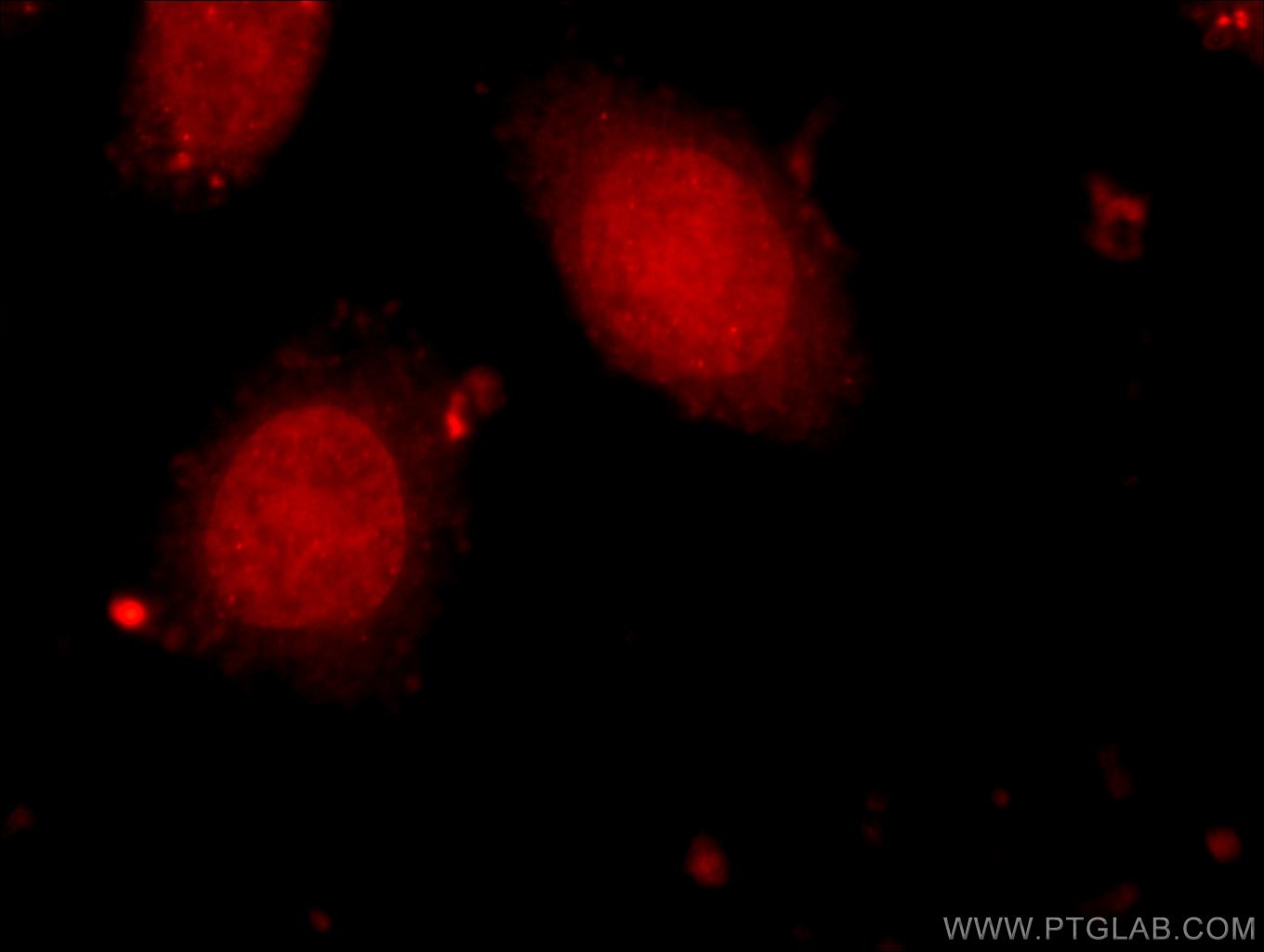 Immunofluorescence (IF) / fluorescent staining of HeLa cells using HELB Polyclonal antibody (24700-1-AP)