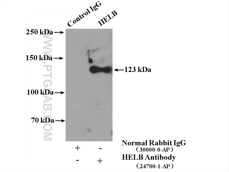 Immunoprecipitation (IP) experiment of HEK-293 cells using HELB Polyclonal antibody (24700-1-AP)