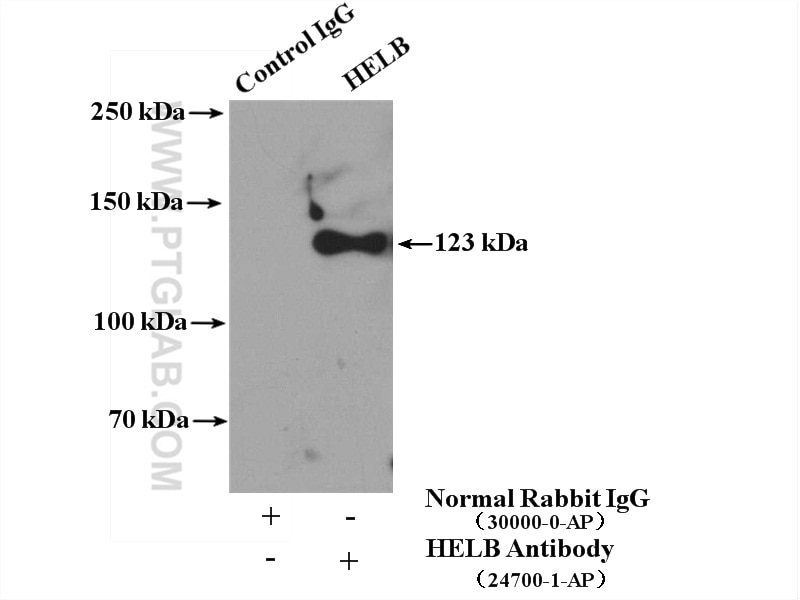 Immunoprecipitation (IP) experiment of HEK-293 cells using HELB Polyclonal antibody (24700-1-AP)