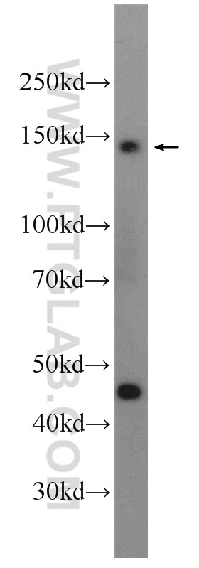 Western Blot (WB) analysis of HeLa cells using HELB Polyclonal antibody (24700-1-AP)