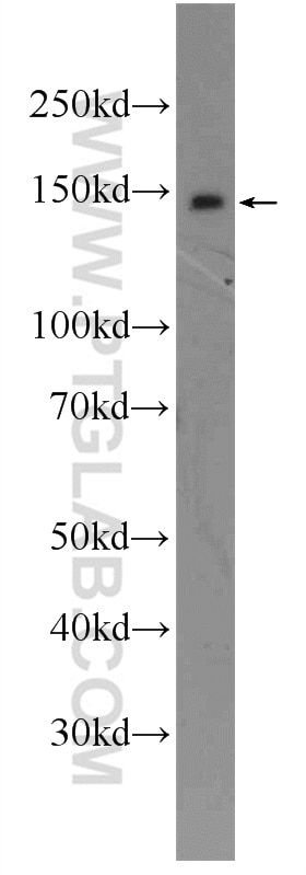 Western Blot (WB) analysis of HEK-293 cells using HELB Polyclonal antibody (24700-1-AP)