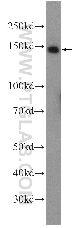 Western Blot (WB) analysis of Jurkat cells using HELB Polyclonal antibody (24700-1-AP)