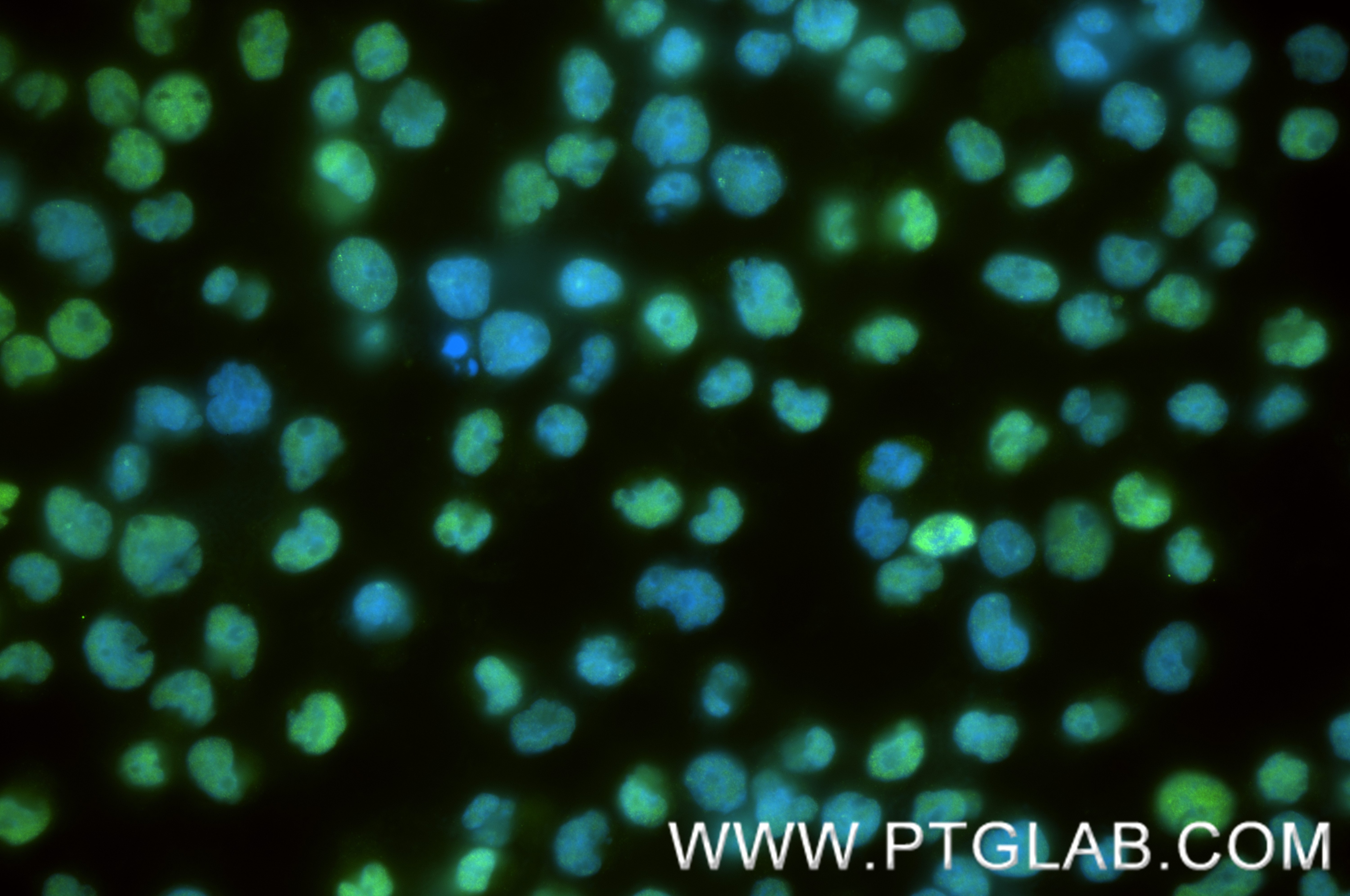 Immunofluorescence (IF) / fluorescent staining of Jurkat cells using HELIOS Recombinant monoclonal antibody (87876-1-RR)