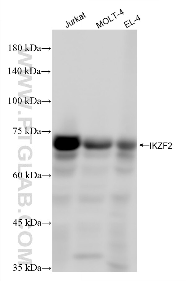 Western Blot (WB) analysis of various lysates using HELIOS Recombinant monoclonal antibody (87876-1-RR)