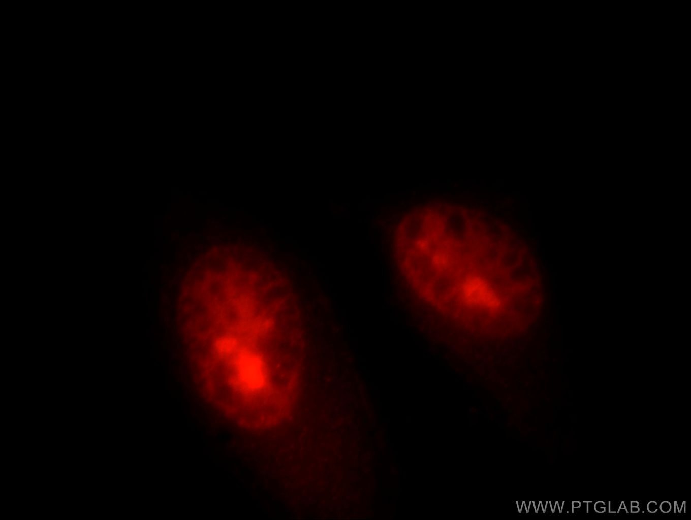 Immunofluorescence (IF) / fluorescent staining of HepG2 cells using HELLS Polyclonal antibody (11955-1-AP)